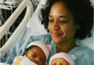 53-Year-Old Woman Gives Birth to Twins—Their Birthmarks Stun Her Son-in-Law – 3Lor